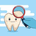 Wisdom Teeth