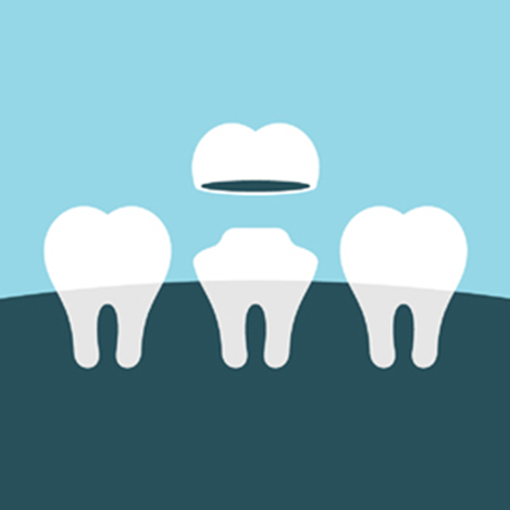 Dental Bridges At South Yarra Family Dental Care